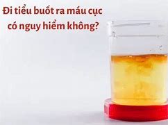 Đi Tiểu Buốt Ra Máu Hồng Ở Nữ Giới